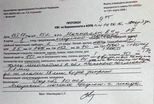 Российского врача судят за подмену органов. Он просто не хотел портить статистику болезни,здоровье,здравоохранение,медицина
